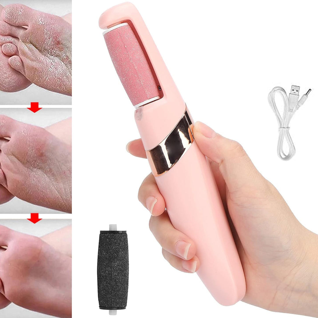 Flawless Pedi Electronic Pedicure Tool – Smooth Feet Care Set (1 Set)
